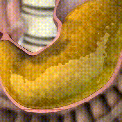 3.gif